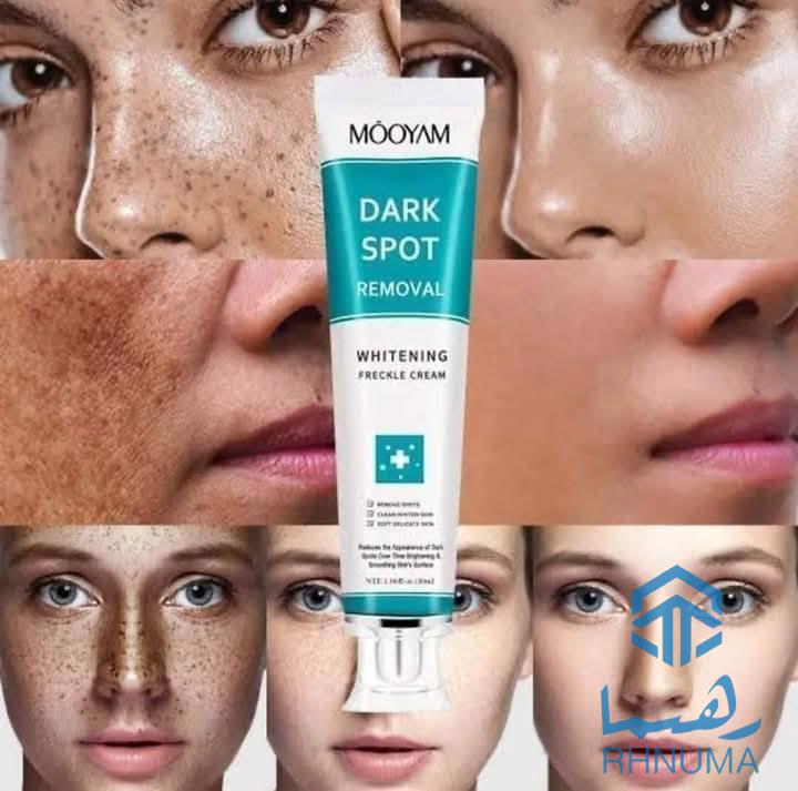 کریم معجزه گر DARK SPOT